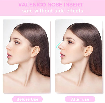 6Pc/Set Nose Shaping Insert