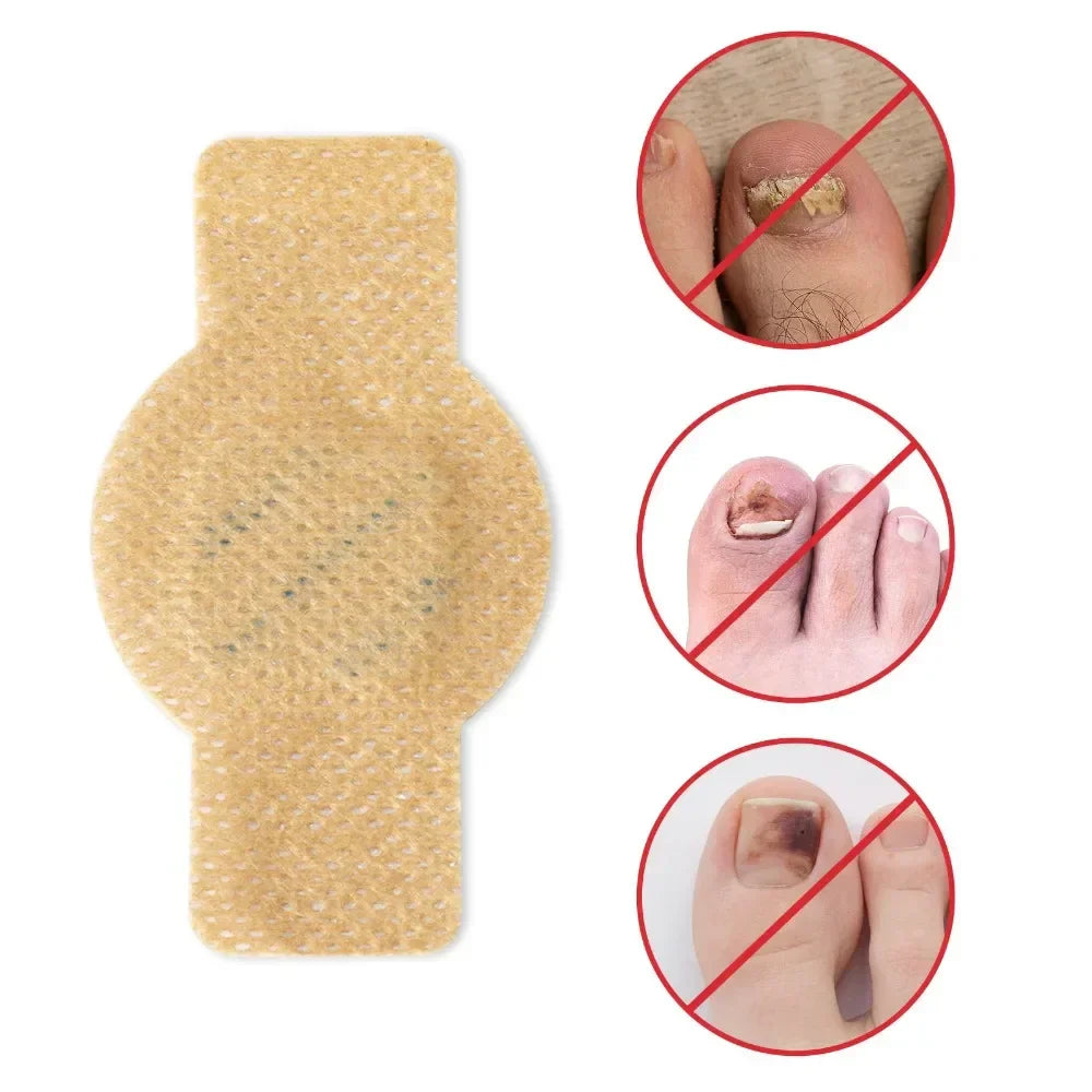Fungal Nail Patches 21 Pcs